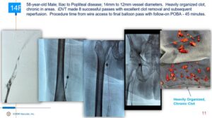 iCHOR Case Study